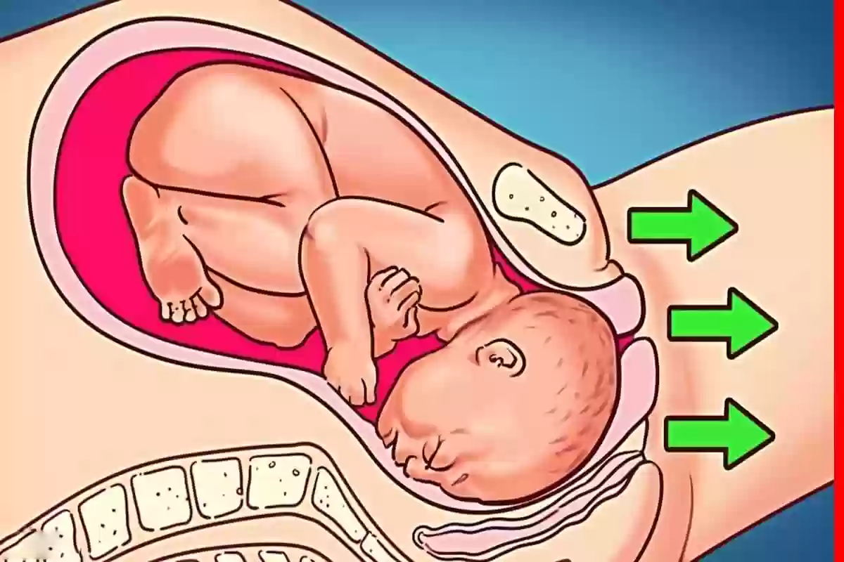 نصائح لتسهيل الولادة وفتح الرحم بسهولة